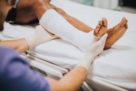 leg in cast to set a bone fracture injury