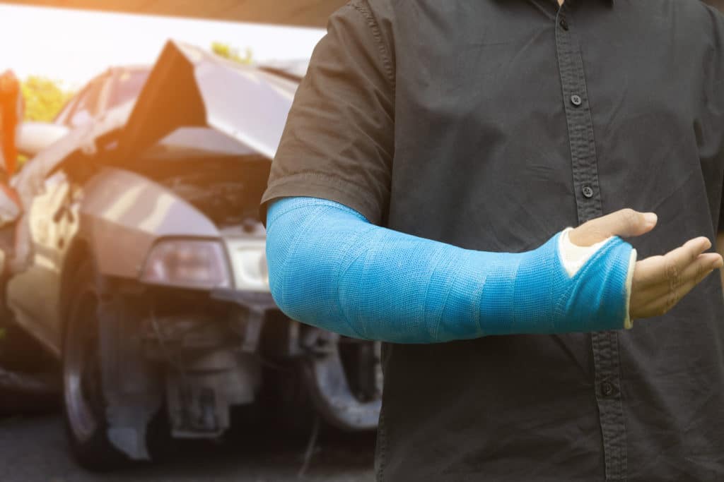Man With A Broken Arm Injury From A Car Accident