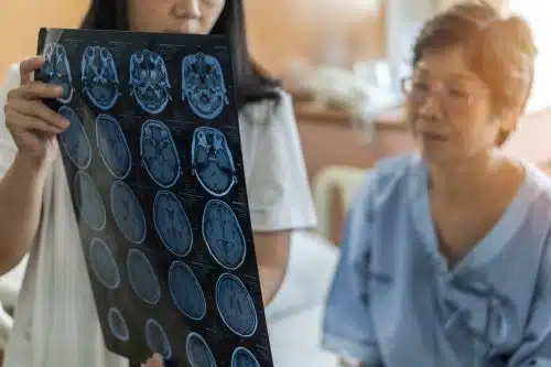 Neurologist looking at brain X Ray scan with patient searching for Traumatic Brain Injury causing stroke