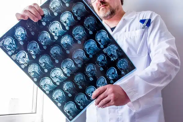 Male neurologist carrying big sheet showing different brain x ray scan to assess Traumatic Brain Injury